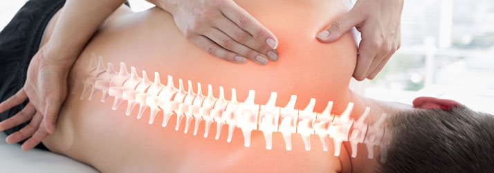 Chiropractic Georgetown ON Scoliosis Help