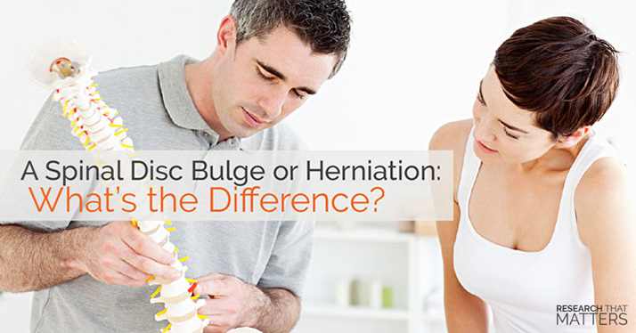 Chiropractic Georgetown ON Bulge or Herniation