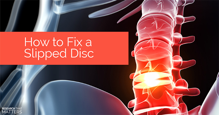 Chiropractic Georgetown ON Slipped Disc